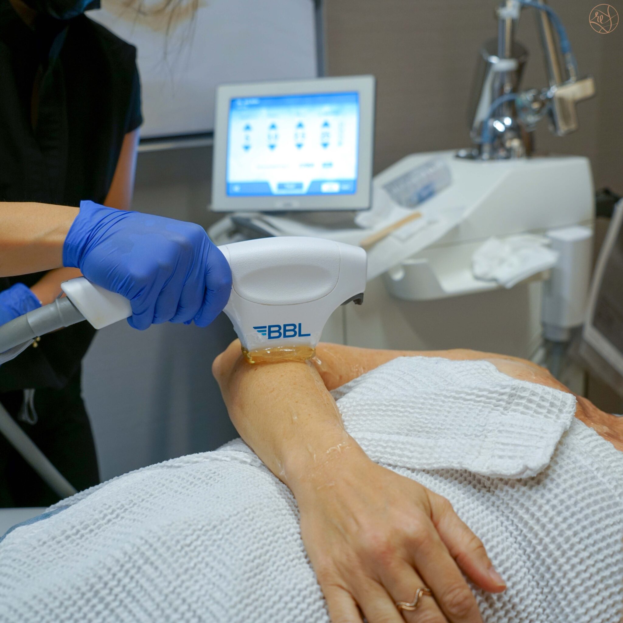 woman getting skin treatment